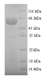 Human P4hb protein