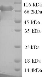 Human PARN protein