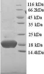 Human PHPT1 protein