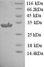 Rat Plaur protein