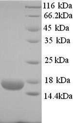 Human ROPN1B protein