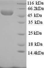 Rabbit SELE protein