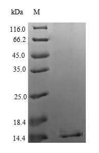 Human SIVA1 protein