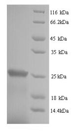 Human SOCS1 protein