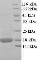 Mouse Sod1 protein