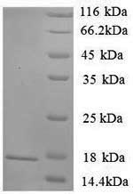 Rat Sort1 protein