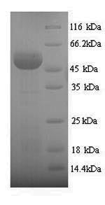 Human SUOX protein