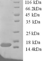 Human TANK protein