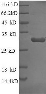 Rabbit TFPI protein