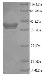 Human TPO protein