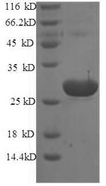 Mouse Tpt1 protein