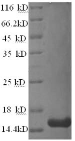 Human TSPAN7 protein