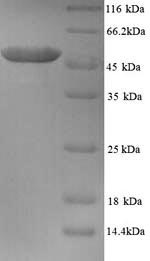 Human TUBB2A protein