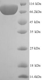 Human VCAM1 protein