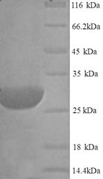 Rat Dio2 protein