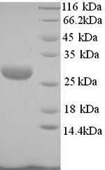 Yeast lktA protein