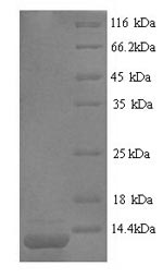 Yeast Con-ikot-ikot protein