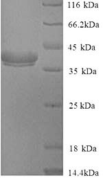 Yeast Allergen Cry j I protein