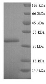 E. coli nfsA protein
