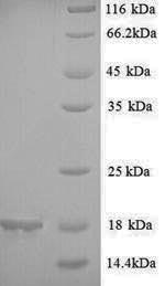 Yeast GM2S-1 protein