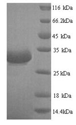 E. coli bla protein
