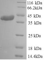 Human S protein