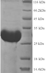 Rat Dio3 protein