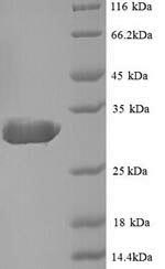 E. coli bla protein