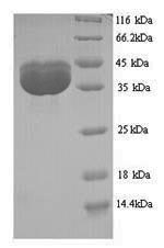 Yeast VP2 protein