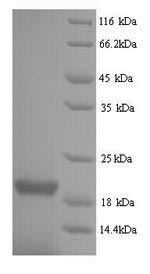 Viral NP protein