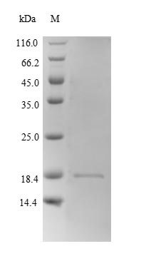 Mouse Hbb-b2 protein