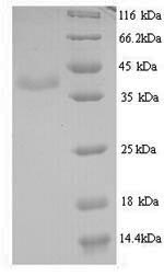 Yeast VP2 protein