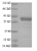 Human E2 protein