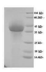 Human VP1 protein