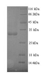 E. coli fimH protein