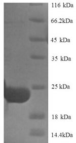 Yeast Trypsin inhibitor DE-3 protein