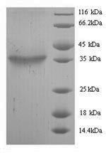 Yeast Toxin zeta protein