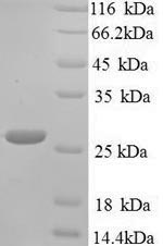 Yeast blaNDM-1 protein