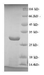 Human gL protein