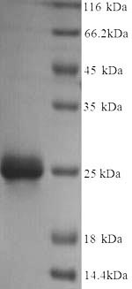 Yeast rpiA protein