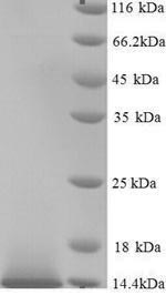 Human GUCA2B protein