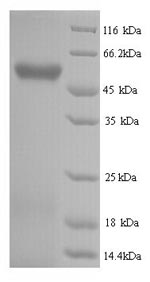 Human HYAL2 protein