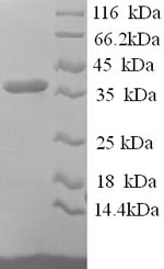 Human RCN1 protein