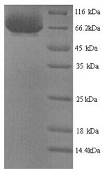 Human PTK7 protein
