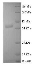 Mouse Jak3 protein