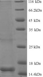 Human BEND3 protein