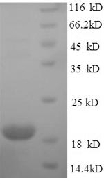 Human ILDR2 protein