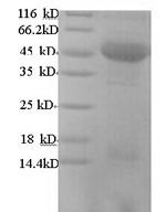 Human DCP2 protein