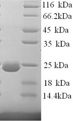 Human DST BP230 protein