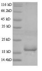 Mouse Gm6484 protein
